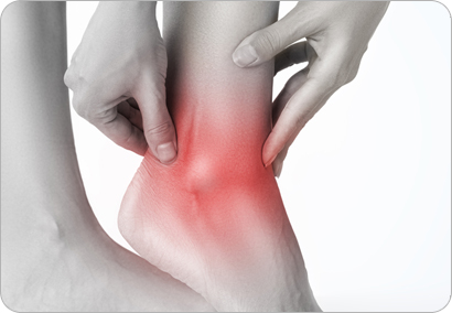 인대손상(발목, 삠, 무릎) 습관성 탈구