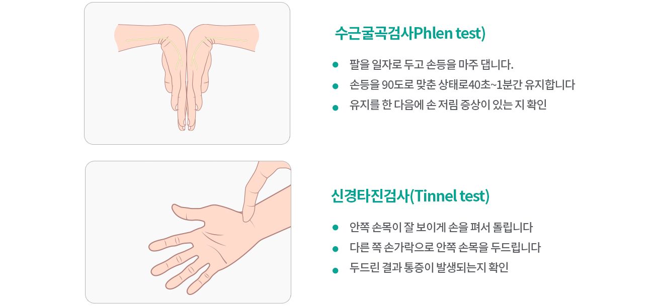 반월상연골판파열