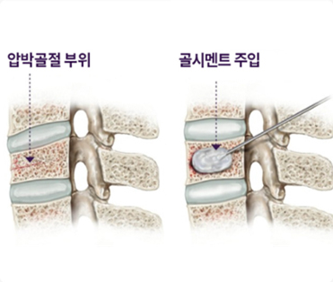 약물치료