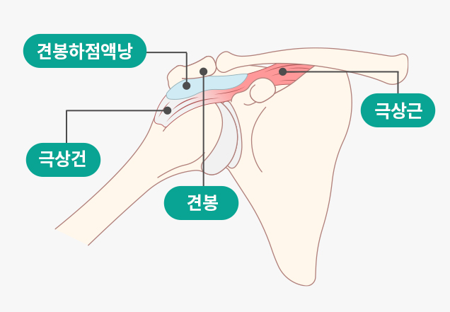 정상어깨