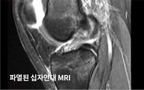 도플러 초음파 검사