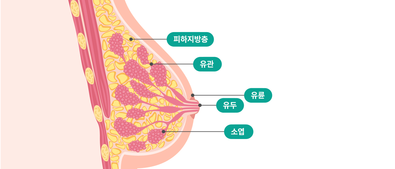 유방양성질환