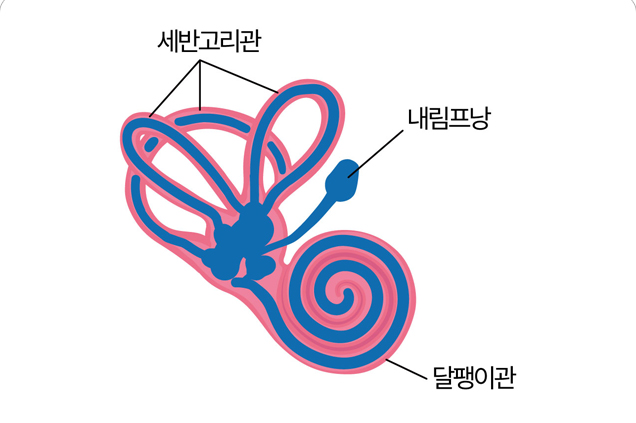 만성신부전증