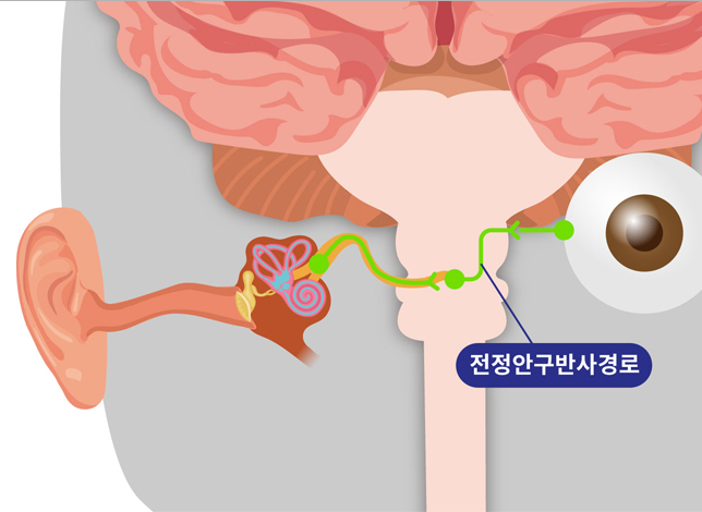 만성신부전증