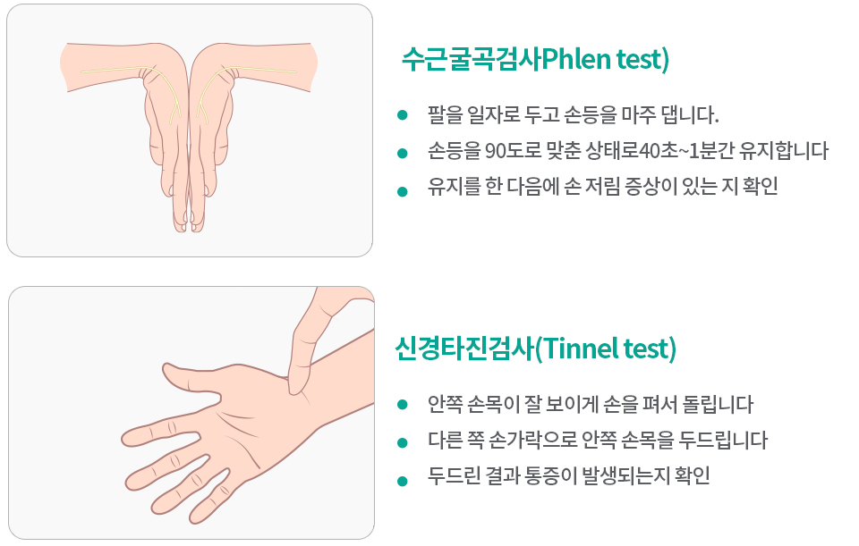 반월상연골판파열