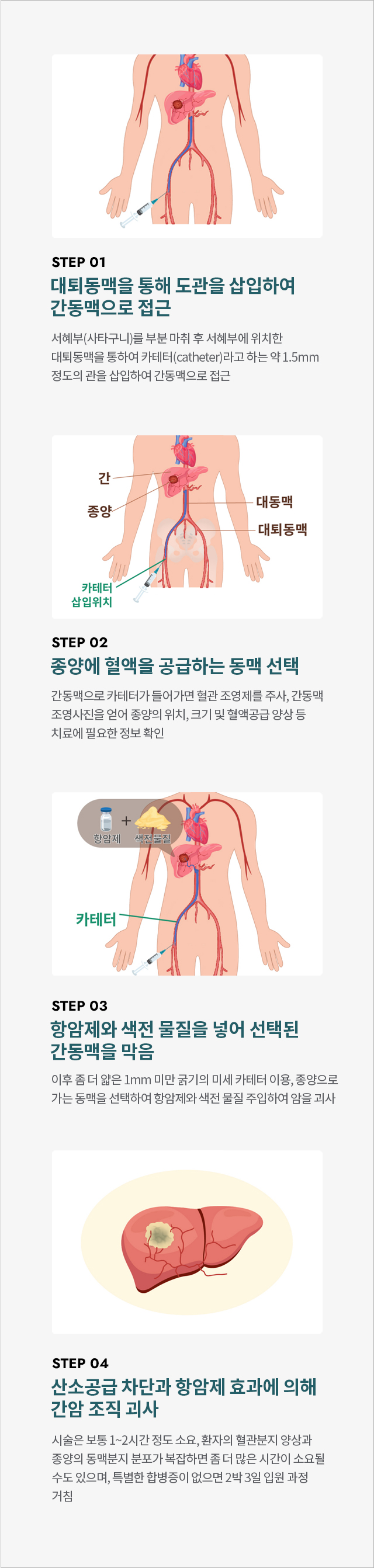 척추센터