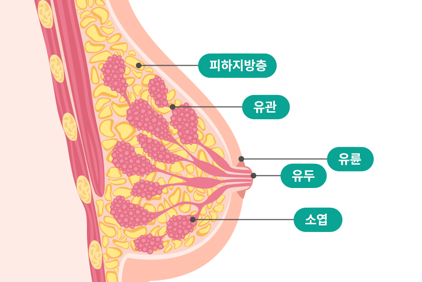 유방양성질환